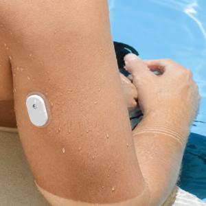 SIBIONICS CGM